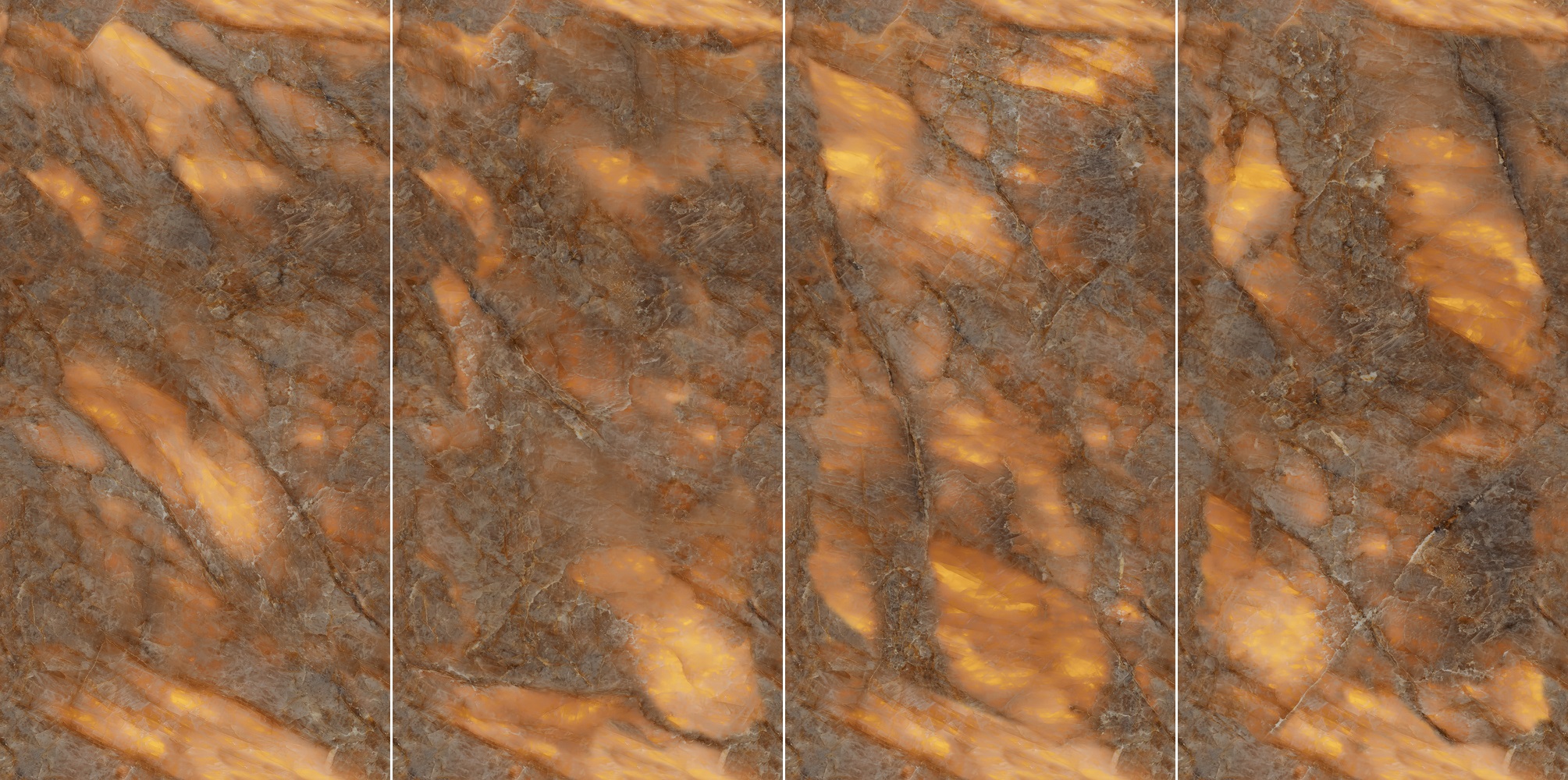 AVS Coronal Onyx